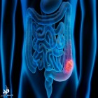 کارشناسان اعلام کردند؛