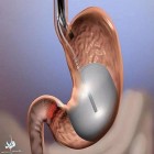 گزارش محققان دانشگاه هاروارد؛