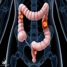 مطالعات نشان می‌دهد؛